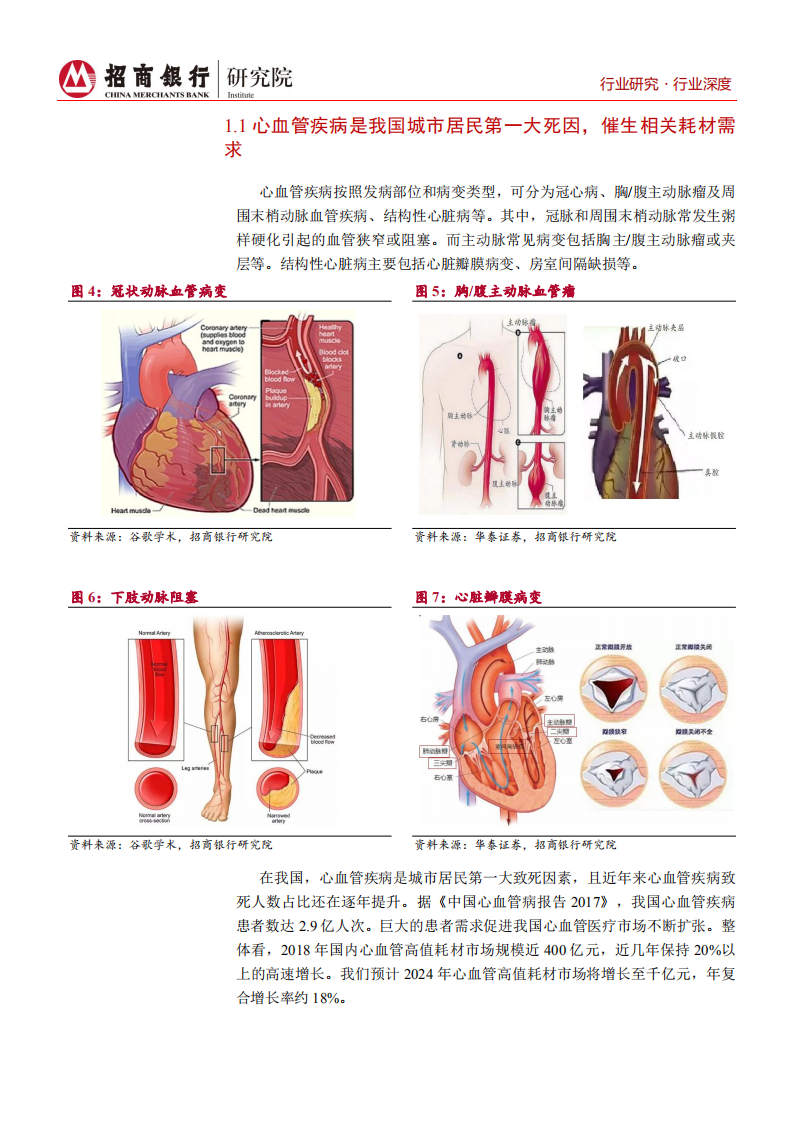 生物医药行业之心血管耗材篇：关注行业龙头扩张及创新企业增长-200623.pdf 第6页