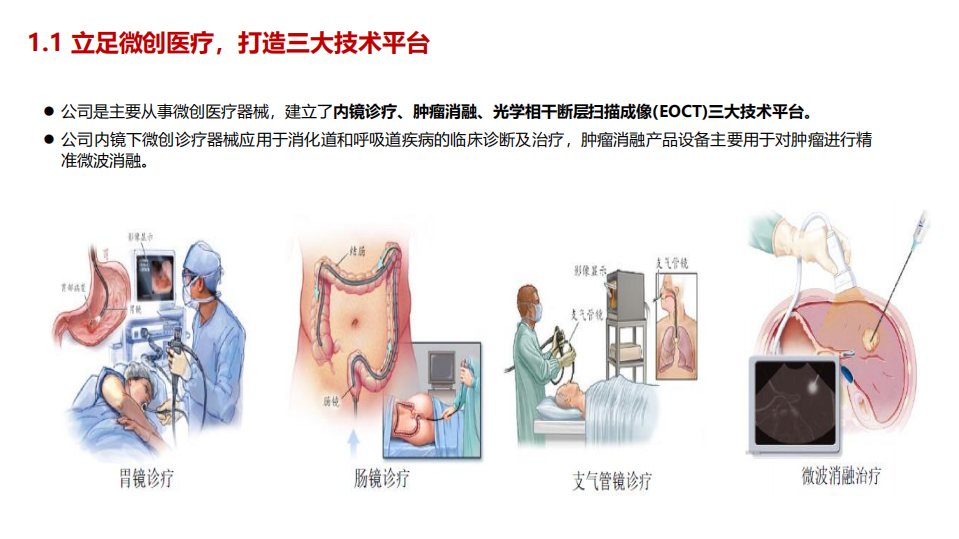 南微医学-公司深度报告：内镜微创手术耗材国产龙头，多技术平台推动国产替代助高成长-210301.pdf 第5页