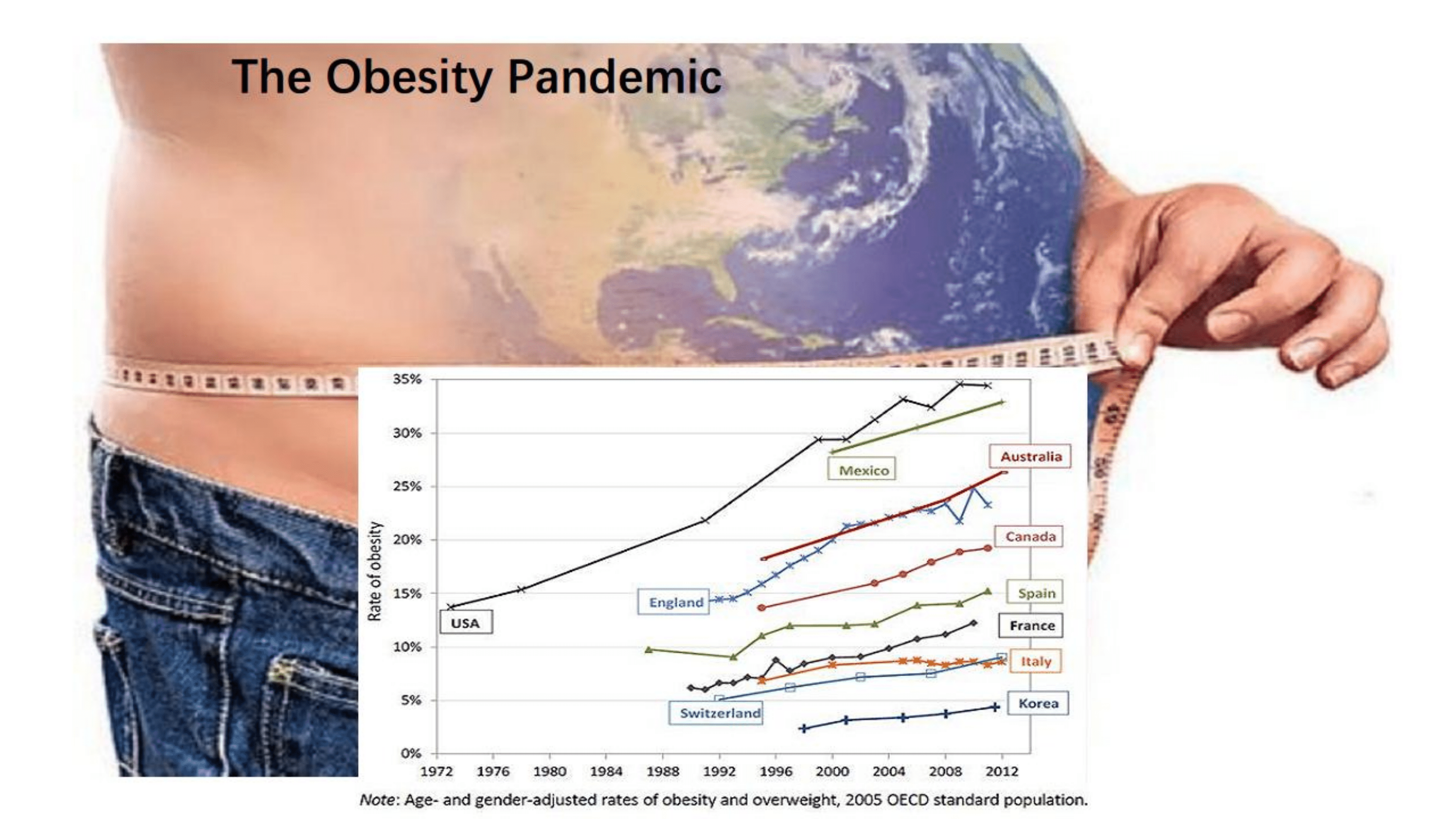 北京协和医院：从饮食运动到药物到手术-如何科学减重？（2022）.pdf 第4页